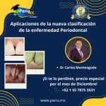 Aplicaciones de la nueva clasificación de la enfermedad Periodontal $USD
